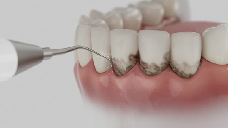 Trusted Wisdom Tooth Removal service in Wilton, CA - Dentist Open Now
